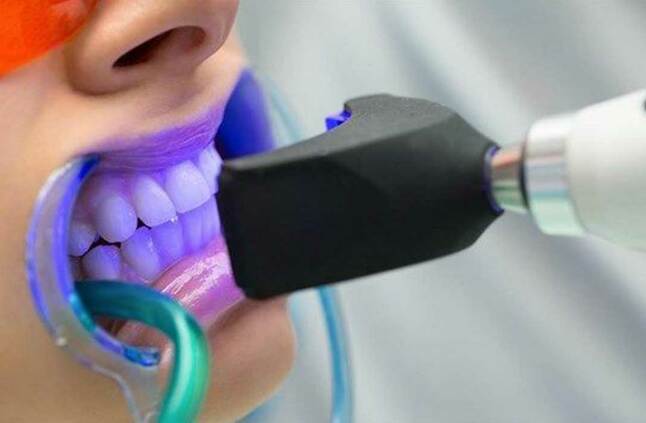 أضرار تبييض الأسنان بالليزر كل يوم معلومة طبية صحة