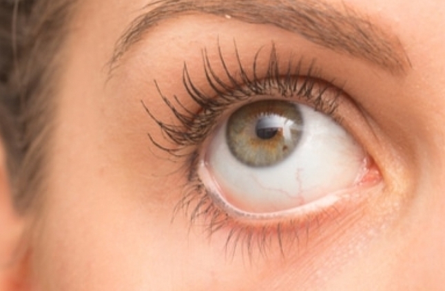 علاج الكيس الدهني في العين بدون جراحة